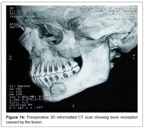 oral-hygiene-health-preoperative-reformatted