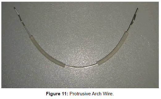 oral-hygiene-health-protrusive-arch-wire