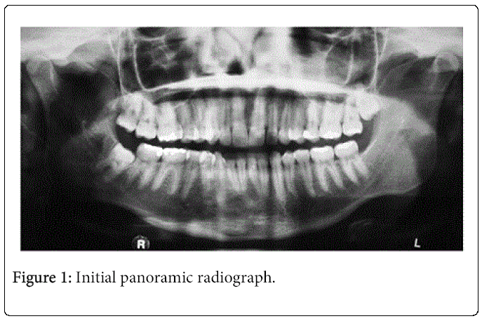 oral-hygiene-health-radiograph