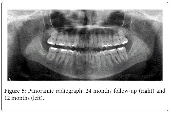 oral-hygiene-health-radiograph