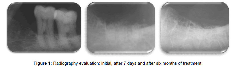 oral-hygiene-health-radiography-evaluation