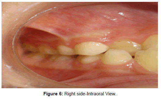 oral-hygiene-health-right-intraoral-View