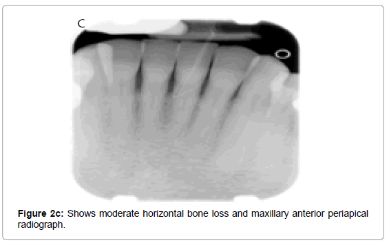 oral-hygiene-health-shows-moderate-horizontal