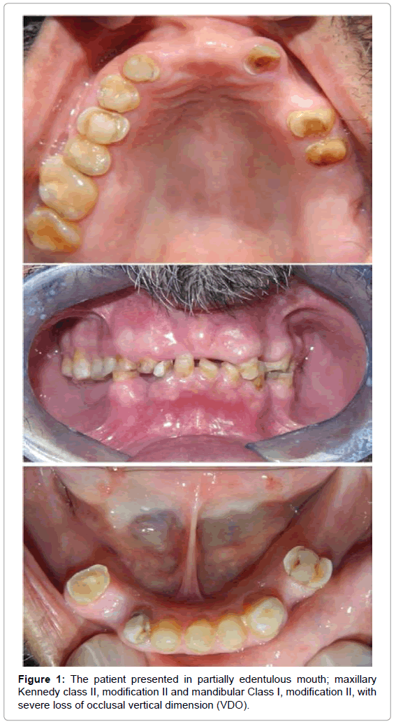 oral-hygiene-health-the-patient-presented