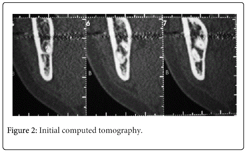 oral-hygiene-health-tomography