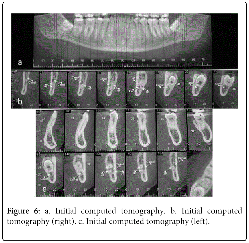 oral-hygiene-health-tomography