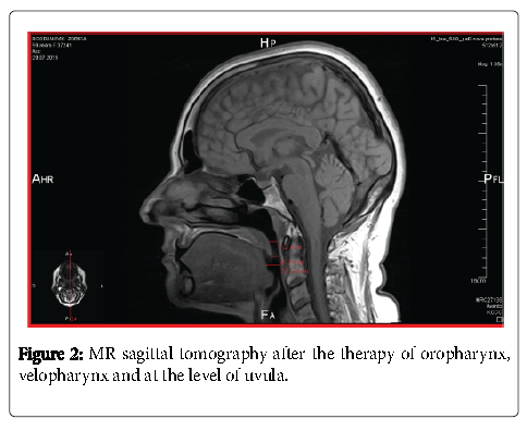 oral-hygiene-health-tomography