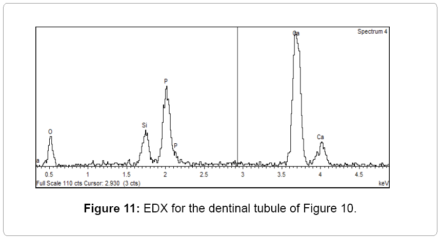 oral-hygiene-health-tubule