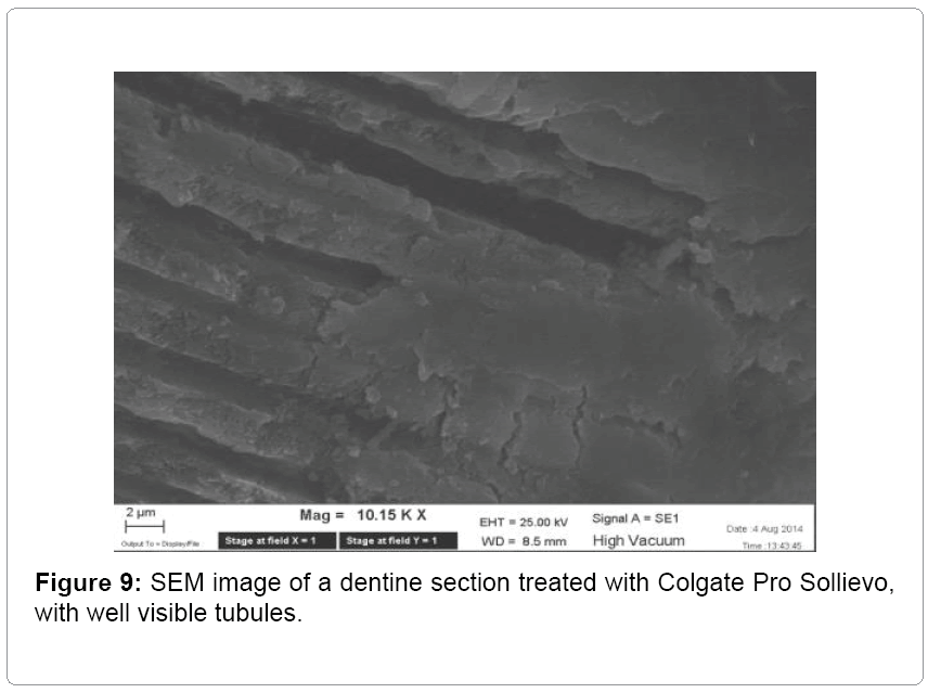 oral-hygiene-health-tubules