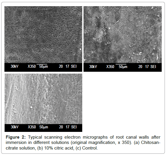 oral-hygiene-health-typical-scanning-electron
