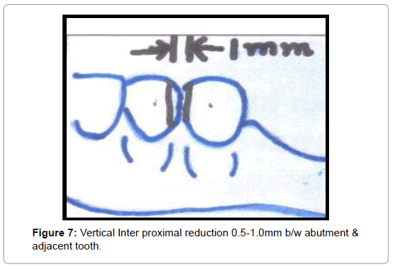 oral-hygiene-health-vertical-inter-proximal