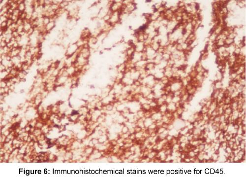 orthopedic-oncology-Immunohistochemical