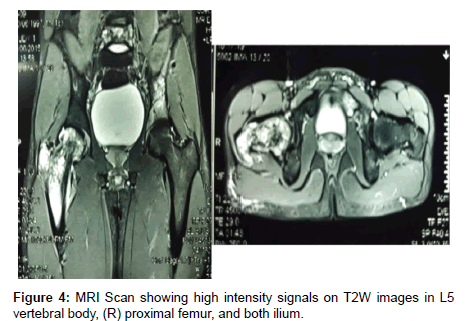 orthopedic-oncology-MRI-Scan