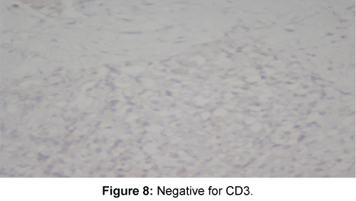 orthopedic-oncology-Negative