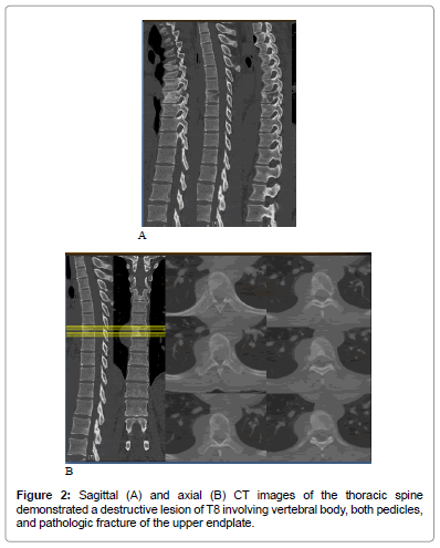 orthopedic-oncology-Sagittal-axial-CT-images
