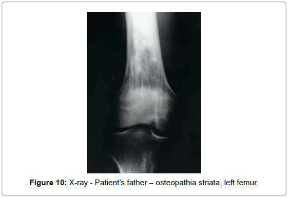 orthopedic-oncology-X-ray-Patient-father