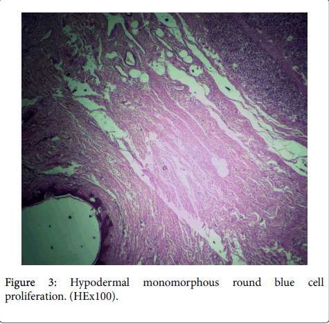 orthopedic-oncology-blue-cell