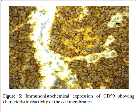 orthopedic-oncology-characteristic-reactivity