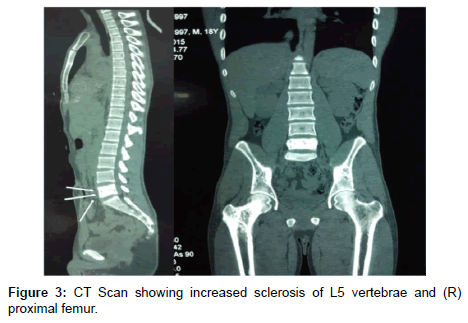 orthopedic-oncology-increased