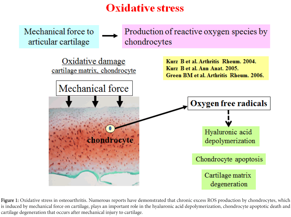 osteoarthritis-Oxidative-stress-osteoarthritis