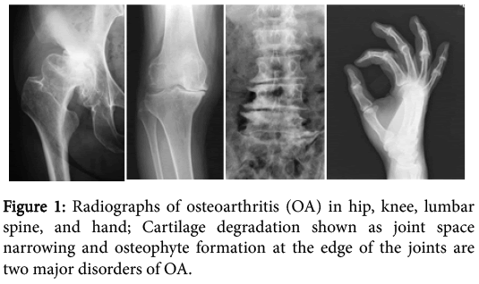 Mechanisms of Osteoarthritis from Animal Models | OMICS International Mechanisms of Osteoarthritis from Animal Models | OMICS International