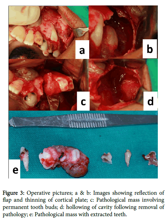 otolaryngology-Operative-pictures