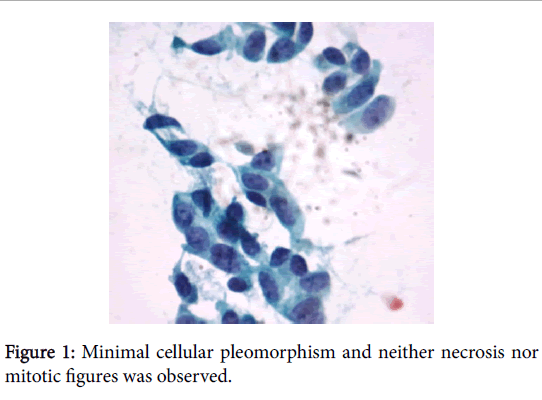 otolaryngology-cellular-pleomorphism