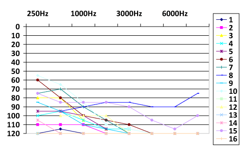 Cochlear Share Price Chart