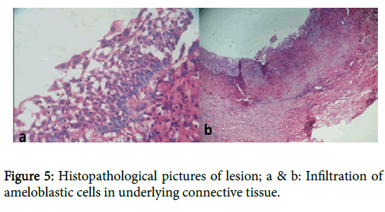 otolaryngology-connective-tissue
