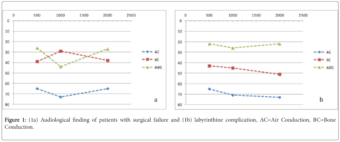 otolaryngology-open-access-Audiological-finding