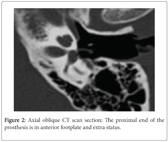 otolaryngology-open-access-Axial-oblique