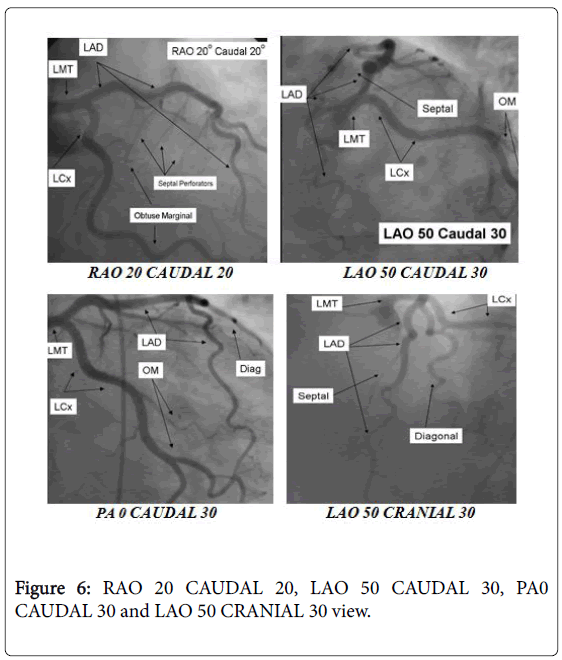 pain-relief-CRANIAL-30-view