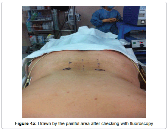 pain-relief-Drawn-painful-area