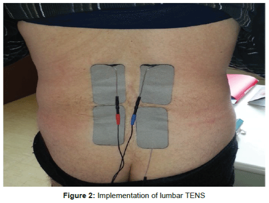 pain-relief-Implementation-lumbar-TENS
