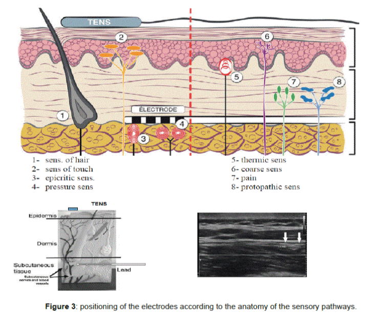 pain-relief-anatomy-sensory-pathways