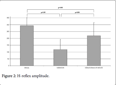 pain-relief-reflex-amplitude