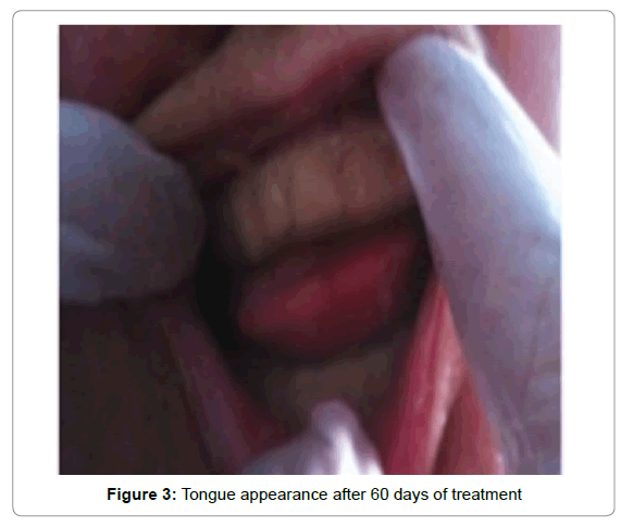palliative-care-medicine-60-days-treatment