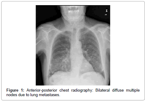 palliative-care-medicine-Anterior-posterior