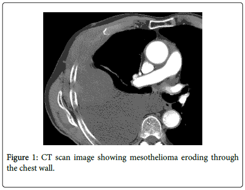 palliative-care-medicine-CT-scan