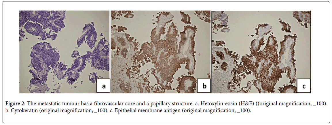 palliative-care-medicine-Hetoxylin-eosin
