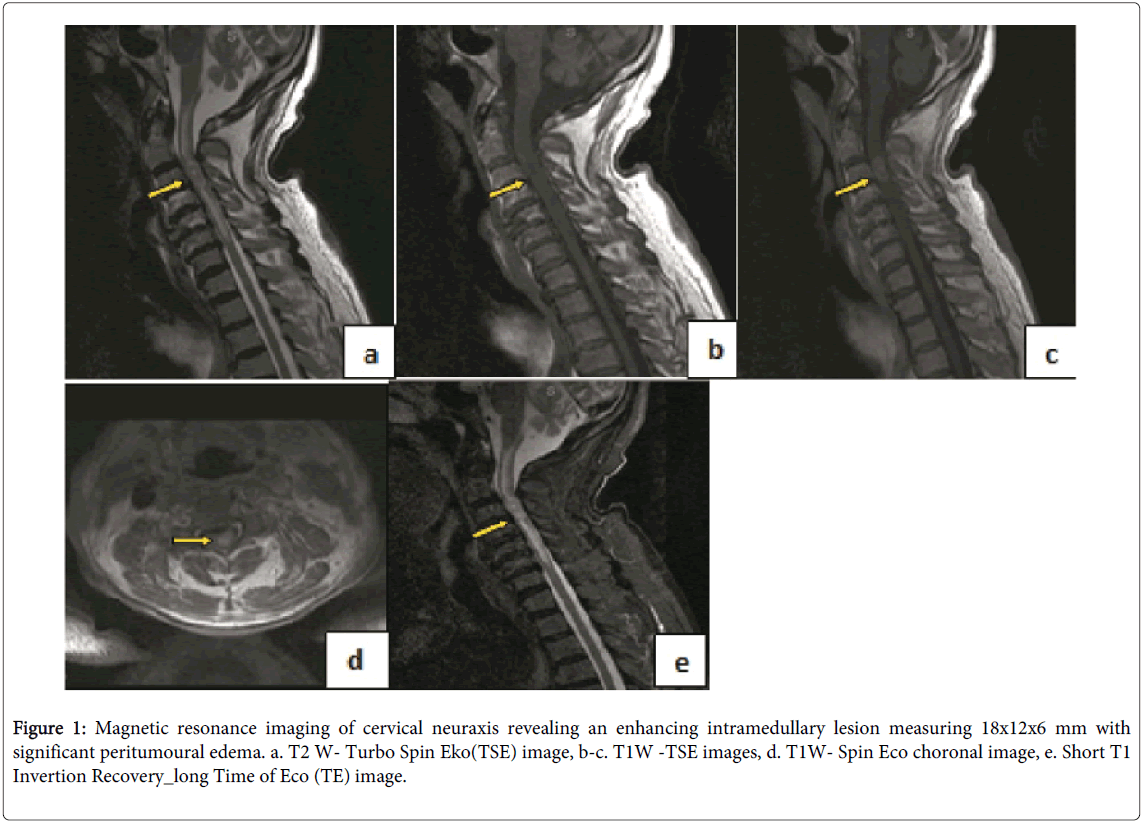 palliative-care-medicine-Magnetic-resonance-imaging