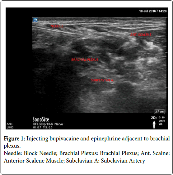 palliative-care-medicine-Subclavian-Artery
