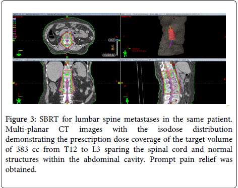 palliative-care-medicine-lumbar-spine