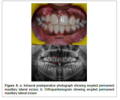 pediatric-dental-care-lateral