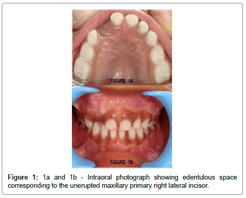 pediatric-dental-care-photograph