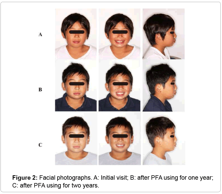 pediatric-dental-care-Facial