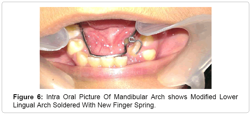 pediatric-dental-care-Modified