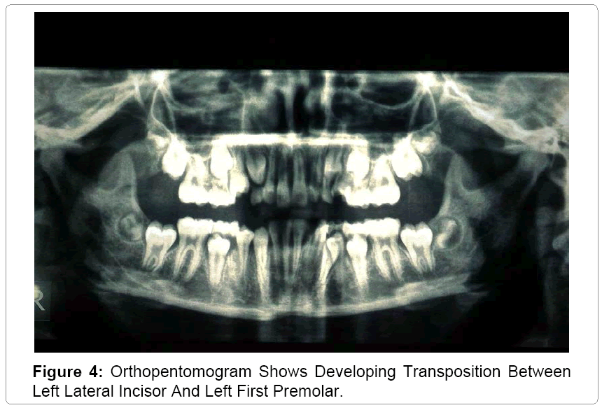 pediatric-dental-care-Orthopentomogram
