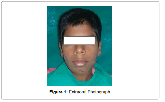 pediatric-dental-care-Photograph
