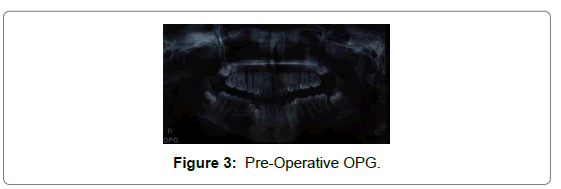 pediatric-dental-care-Pre-Operative